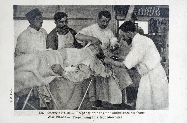 Vieille carte postale de la guerre des 14, trépanation dans une ambulance du visage — Photo