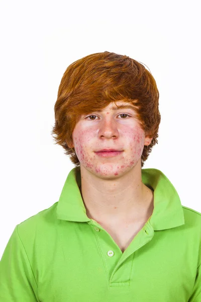 Attractive boy in puberty with red hair — Stock Photo, Image