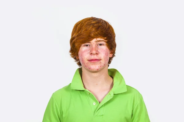 Attractive boy in puberty with red hair — Stock Photo, Image