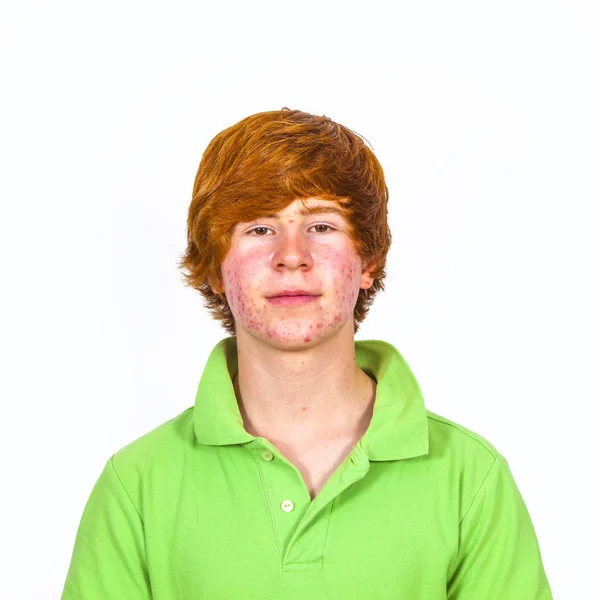 Attractive boy in puberty with red hair — Stock Photo, Image