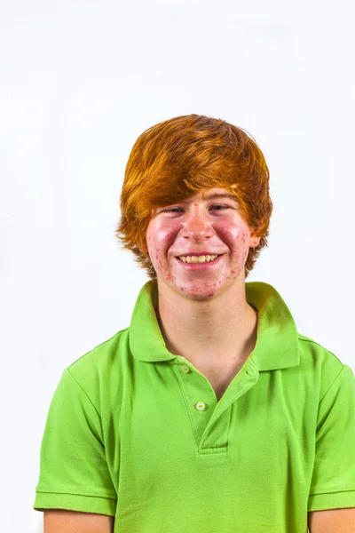 Attractive boy in puberty with red hair — Stock Photo, Image