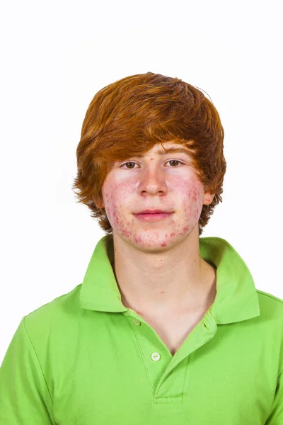 Attractive boy in puberty with red hair Royalty Free Stock Images