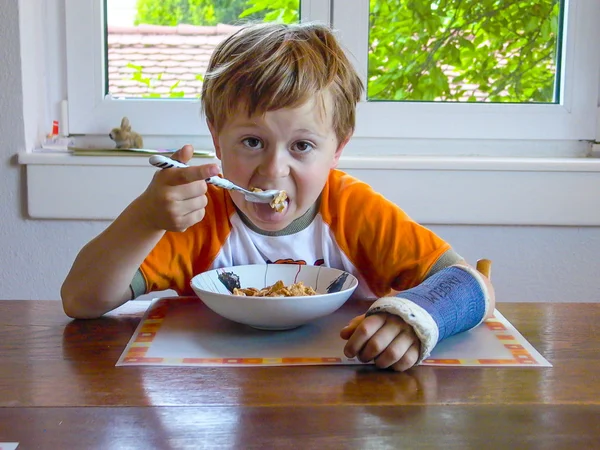 Niño con brazo en yeso desayuna en la mesa —  Fotos de Stock