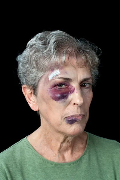 Beaten elderly woman — Stock Photo, Image