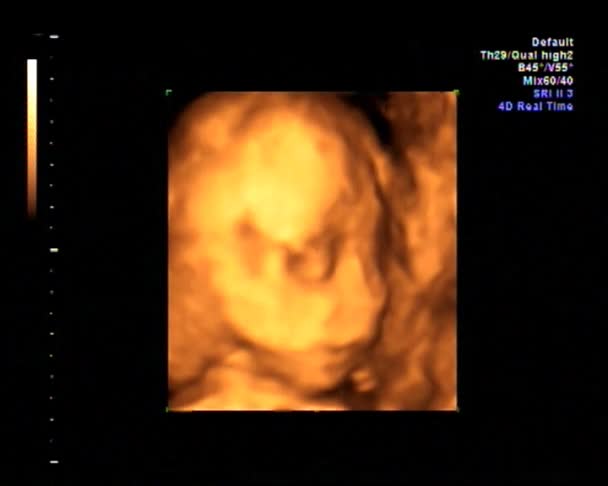 Baby Ultraschall 4d scan — Stockvideo