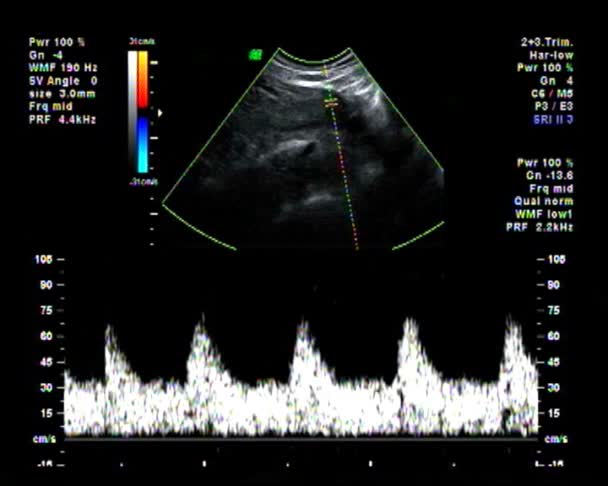Baby ultrazvuk srdce bilo kontrola