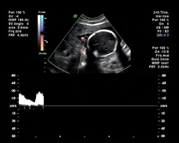 Baby ultrazvuk srdce bít — Stock video