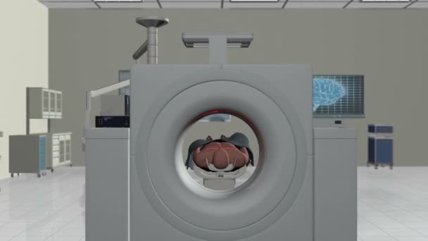 MRI skanowania, aparat latać przez i przystanek na skan mózgu — Wideo stockowe