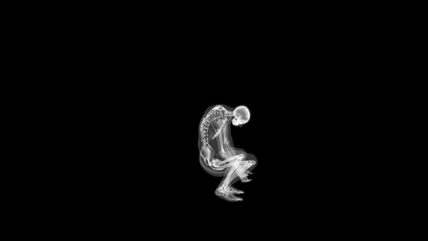 Людське Рентгенівське Тіло Скелет Піднімаючи Петлю Важкого Єкта — стокове відео
