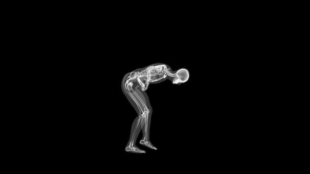Human Xray Body Skeleton Big Stomack Pain Loop — Stockvideo