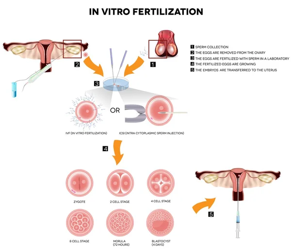 Fecondazione in vitro — Vettoriale Stock