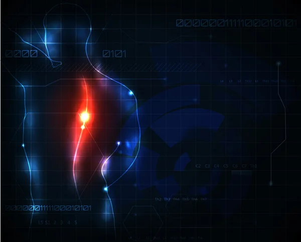 Wirbelsäulenschmerzen — Stockvektor
