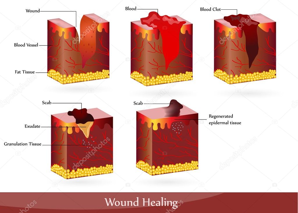 The process of wound healing