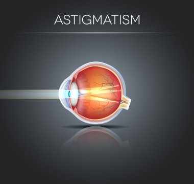Human vision disorder, Astigmatism. Anatomy of the eye, cross se clipart