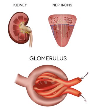 Renal corpuscle and glomerulus, a part of the kidney  clipart