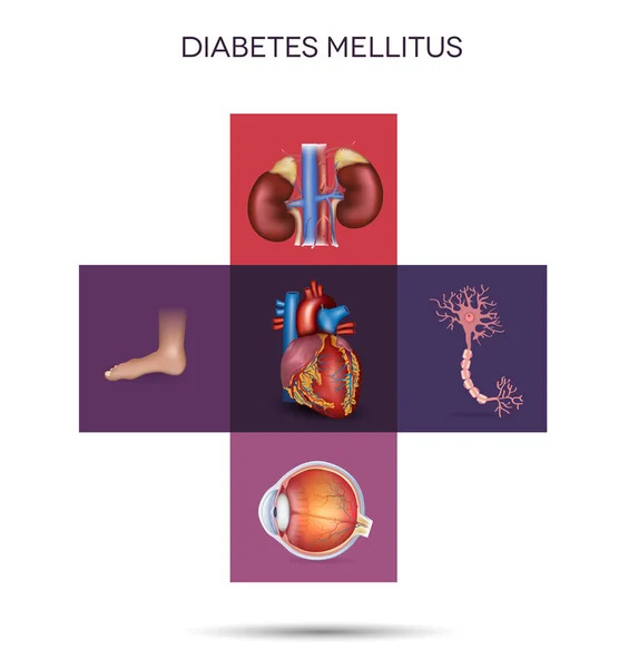 影响糖尿病患者器官 — 图库矢量图片