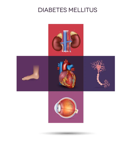 Diabetes mellitus órgãos afetados — Vetor de Stock