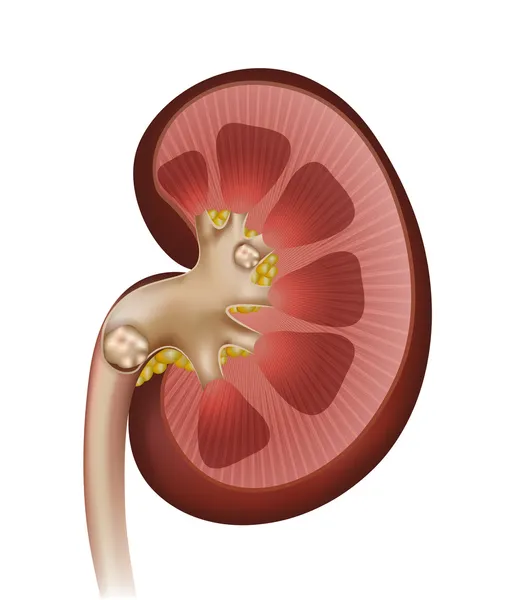 Nierensteine. Detaillierte anatomische Darstellung der Niere — Stockvektor