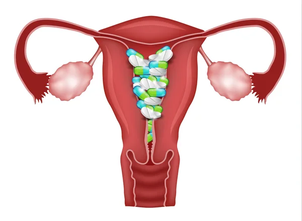 Pillole dentro l'utero — Vettoriale Stock