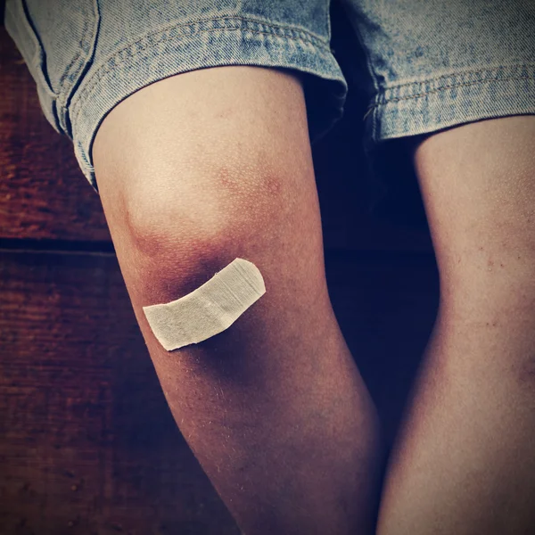 Bruise on the boy's leg Stock Photo by ©chepko 97905654