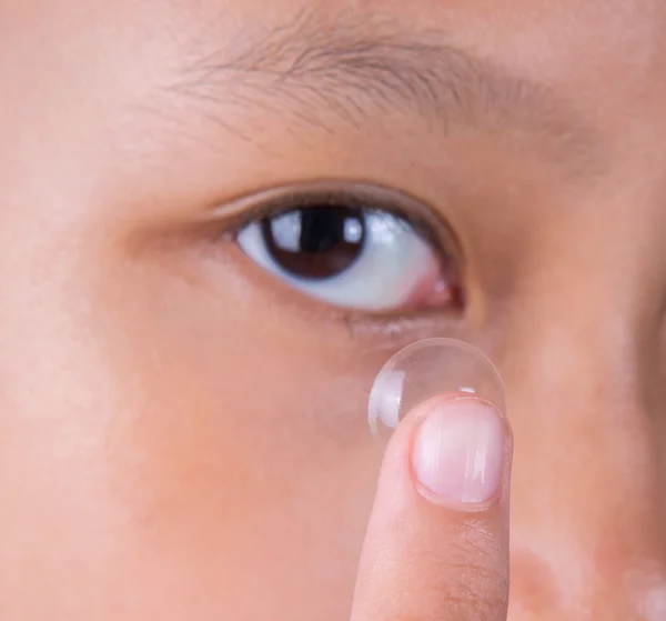 Junge asiatische Mädchen mit Kontaktlinse — Stockfoto