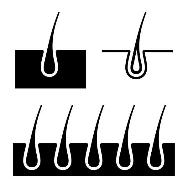Haarfollikel-Symbole gesetzt. Vektor — Stockvektor
