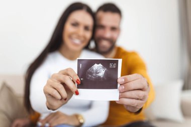 Kadının ve erkek arkadaşının elinde bebeğin ultrasonunun görüntüsü var. Bebek ultrason fotoğrafı olan mutlu genç çift.
