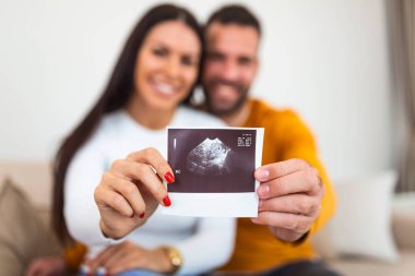 Kadının ve erkek arkadaşının elinde bebeğin ultrasonunun görüntüsü var. Bebek ultrason fotoğrafı olan mutlu genç çift.