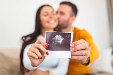Bebek ultrasonu olan mutlu hamile kadın kocasıyla kucaklaşıyor. Kadının elinde bir fetüsün röntgen görüntüsü var.