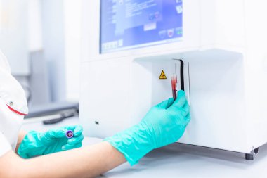 Kan sayımı (cbc) testi için EDTA tüpünde kan tutan laboratuvar teknisyeni hematoloji laboratuvarını test ediyor. Otomatik hematoloji analizi ile bilimsel test.
