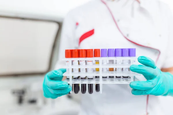 Technician Holding Blood Tube Test Research Laboratory Coronavirus Testing Doctor — Stock Photo, Image