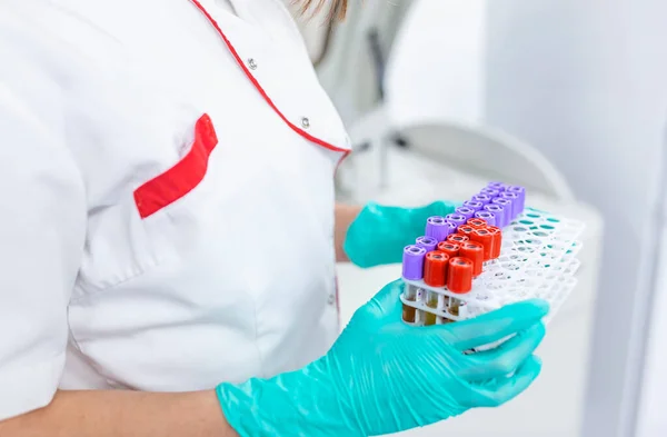 Hand Lab Technician Holding Blood Tubes Test Background Rack Color — Φωτογραφία Αρχείου