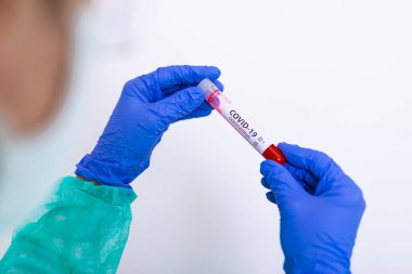 Virüs için kan örnekleri test ediliyor: Epidemiyoloji uzmanı koronavirüs için kan testi yaptırıyor. Salgın Koronavirüs 2019-nCoV, COVID-19