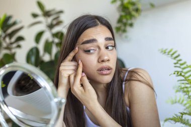 Kadın yüzünde akne ve problem derisinin kavramsal görüntüsü. Genç bir kadının yüzüne sivilce sıkarken çekilmiş bir fotoğrafı.