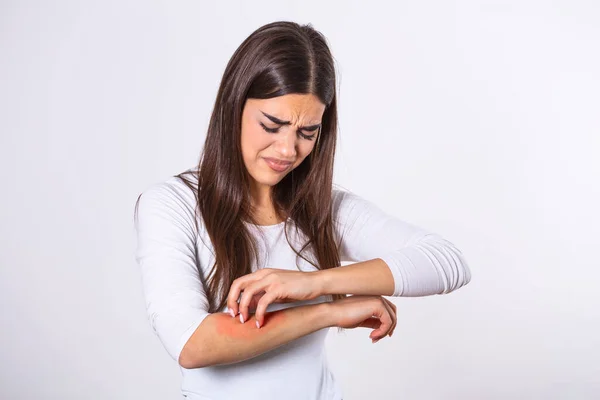 Young Woman Scratching Her Arm Due Itching Gray Background Female — Foto de Stock