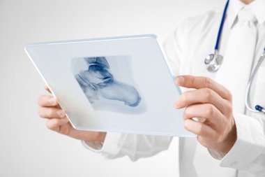 Röntgenli doktor.