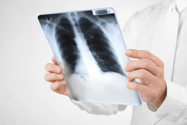 Läkare med röntgen — Stockfoto