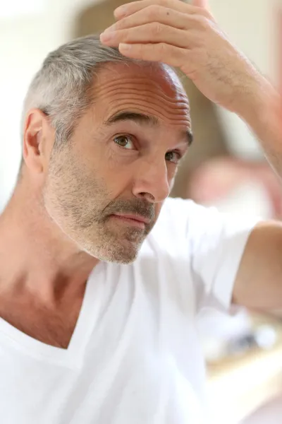 Uomo anziano e perdita di capelli problema — Foto Stock