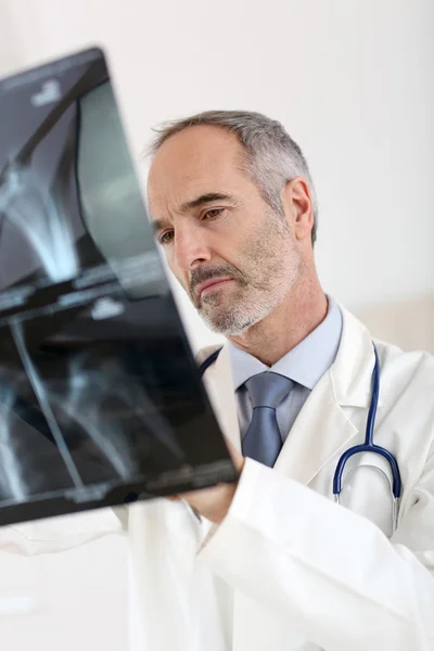 Médico olhando para os resultados de raios-X — Fotografia de Stock