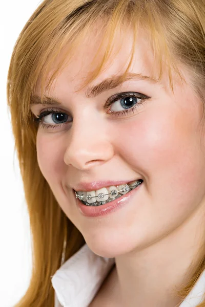 Beautiful young woman with brackets on teeth — Stock Photo, Image