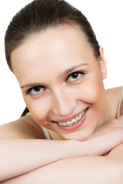 Portrait young woman with brackets on teeth — Stock Photo, Image