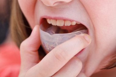 maloklüzyon ortodontik eğitmen tarafından düzeltilmesi