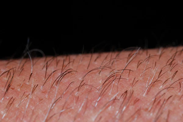 Kulit dengan rambut dalam makro — Stok Foto