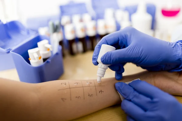 Allergy - skin prick tests — Stock Photo, Image