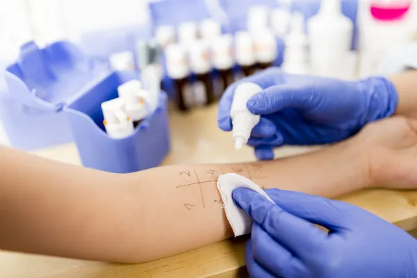 Allergy - skin prick tests — Stock Photo, Image