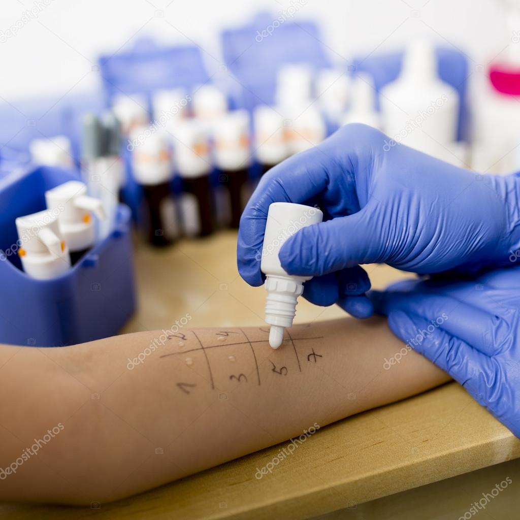 Allergy - skin prick tests