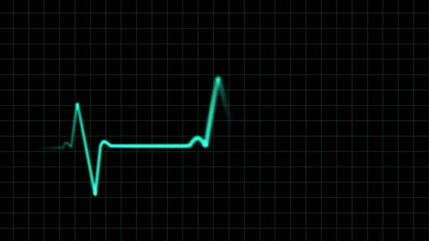 Ekg hartslag monitor, animatie — Stockvideo