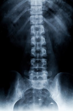 x-ray görüntü