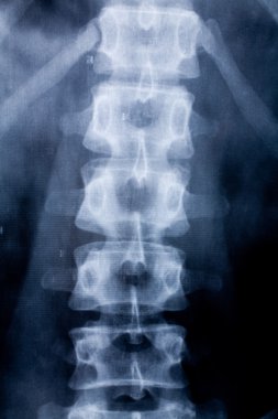 x-ray görüntü
