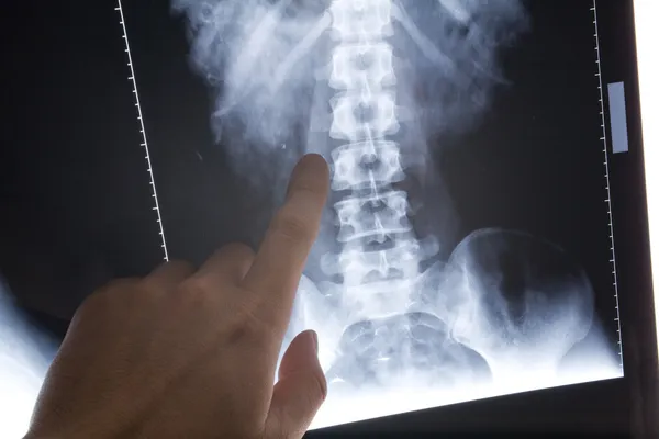 X-ray foto — Stockfoto